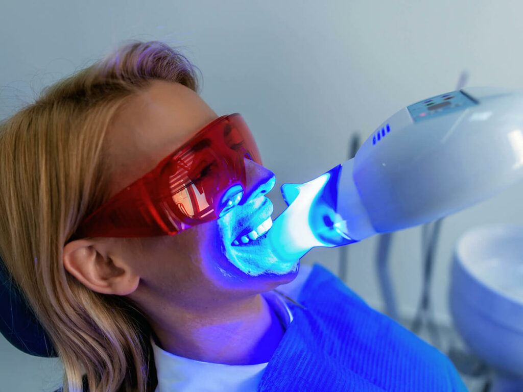 teeth whitening graphic