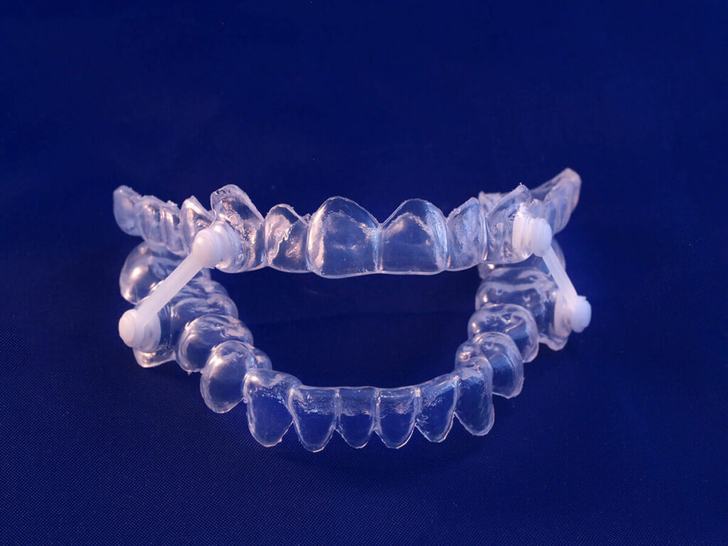 image of sleep apnea oral application