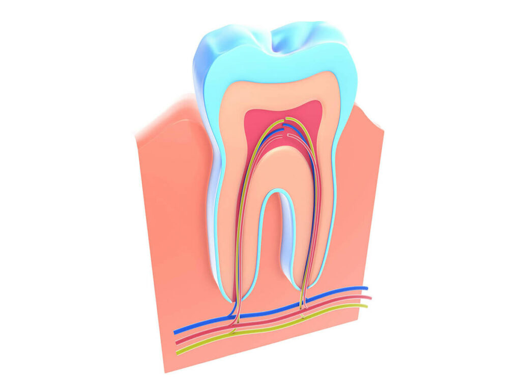 illustration of root canal treatment